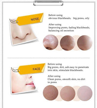 Load image into Gallery viewer, Deep Cleansing Charcoal Mask